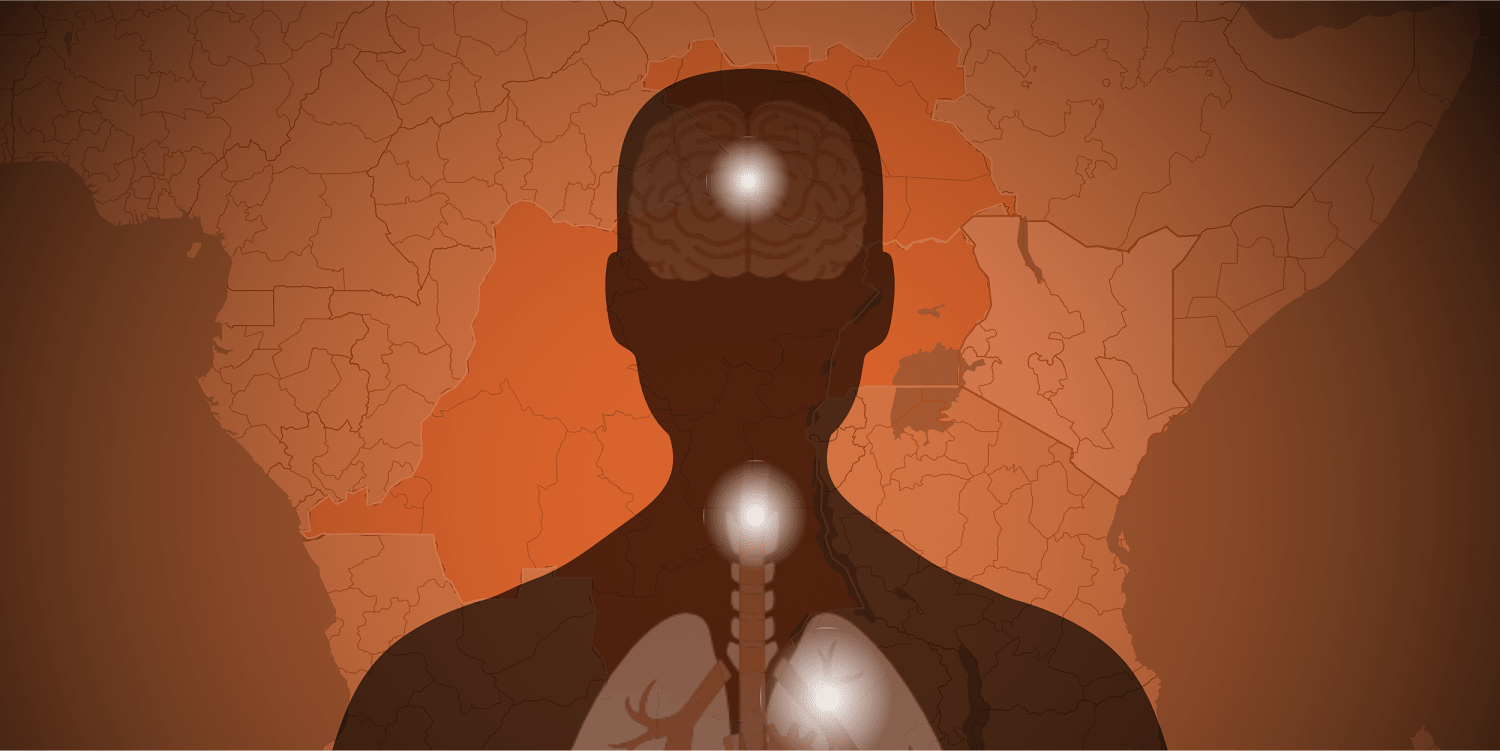 Tracking the Ebola outbreak: Where the deadly virus is spreading